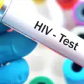 Hiv-cijfers in Suriname veel hoger dan gedacht